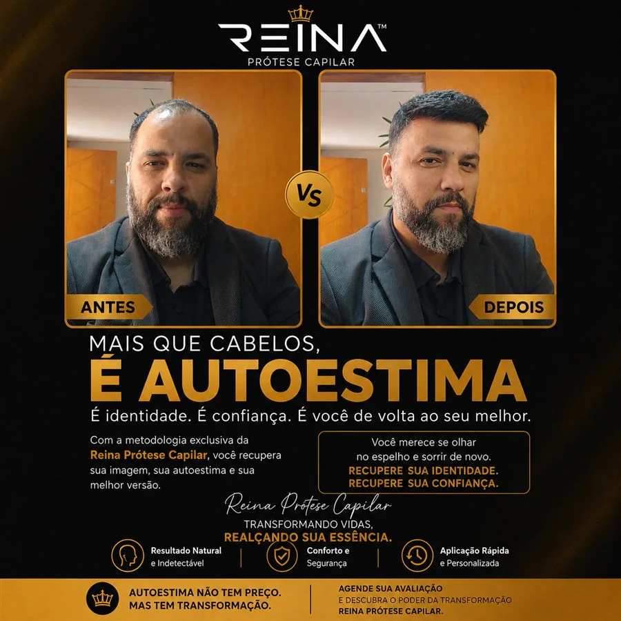 Antes e depois de cliente com barba e prótese capilar natural