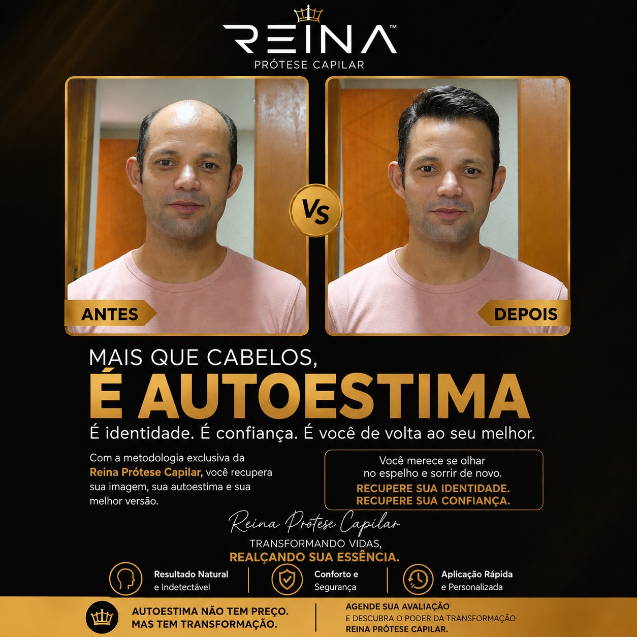 Arte de antes e depois frontal com prótese capilar masculina