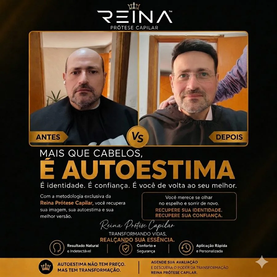 Antes e depois de cliente usando óculos com prótese capilar masculina