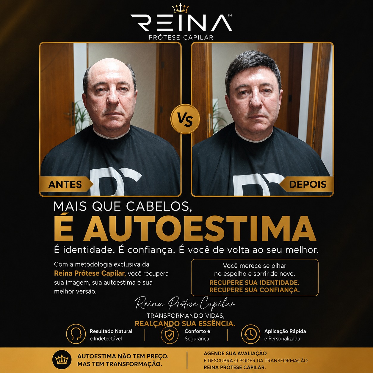 Arte de antes e depois de cliente sênior com prótese capilar