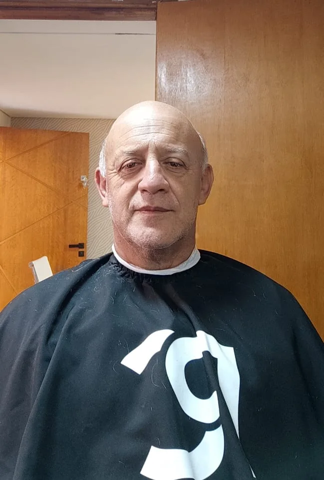 Mesmo cliente do caso 1 antes da aplicação de prótese capilar