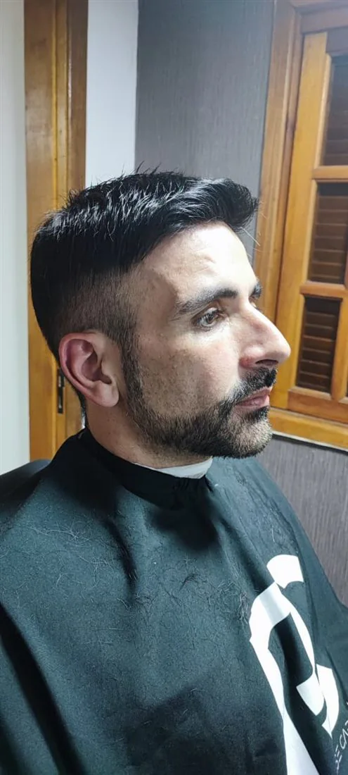 Acabamento lateral de prótese capilar masculina